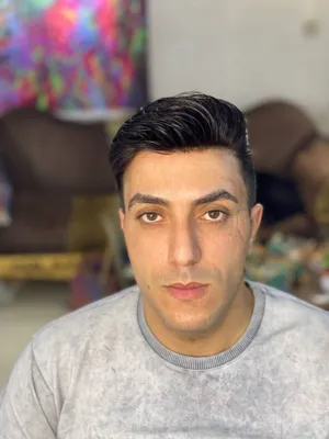 قیمت پروتز مو در شهرضا