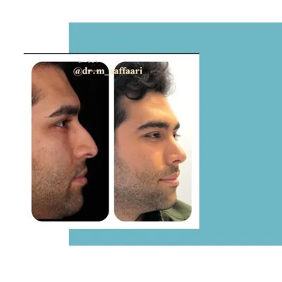 متخصص گوش و حلق و بینی