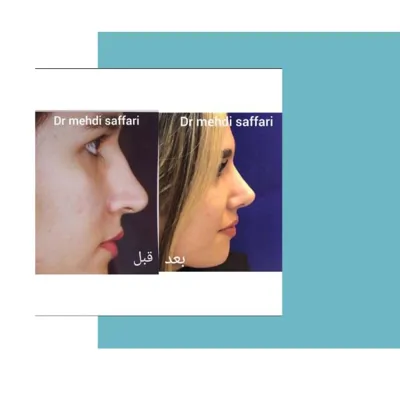 متخصص و جراح بینی
