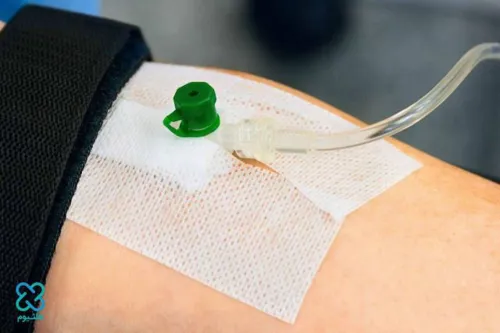 تزریق زولادکس در اصفهان