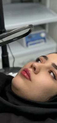 لیزر مو زائد در اصفهان