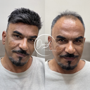پروتز مو بهارستان