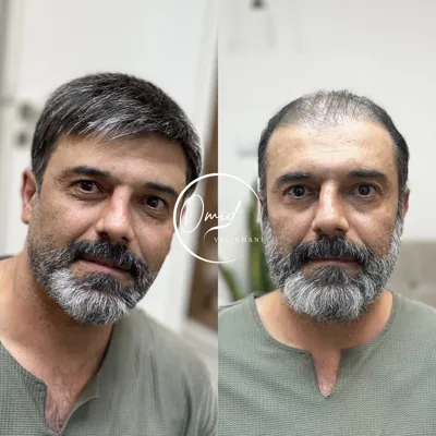 ترمیم مو بهارستان