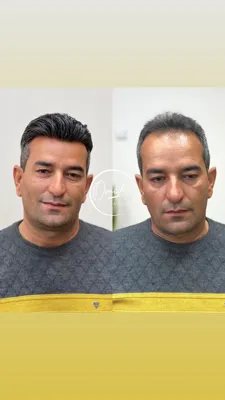 پروتز و ترمیم مو بهارستان