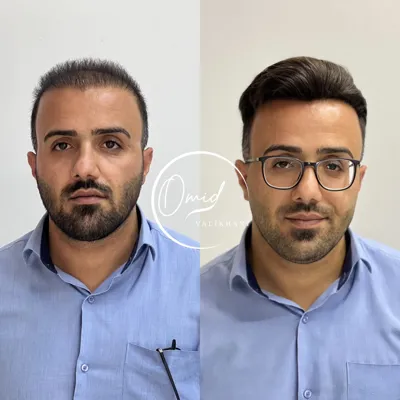 ترمیم مو خمینی شهر