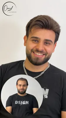 پروتز مو شاهین شهر