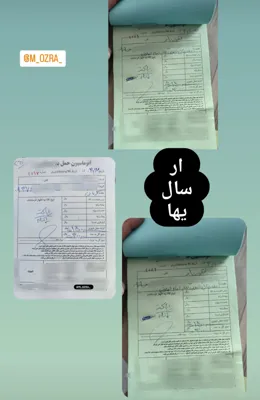 پرده بکارت مصنوعی