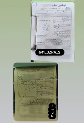 پرده بکارت مصنوعی