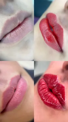 قبل و بعد و ماندگاری کار بهترین فیروزکار کرمان 