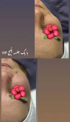 مرکز فیشیال پوست در شاهین شهر
