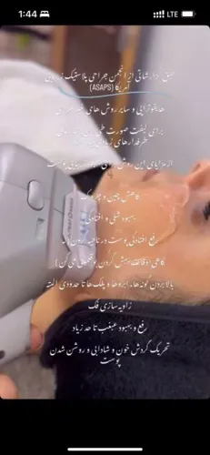 هایفوتراپی چشم