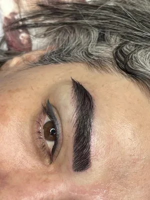 کاشت مو و ابرو در ساری