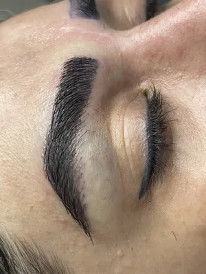 کاشت مو و ابرو در ساری