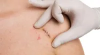 خدمات پرستاری در منزل تجریش
