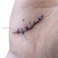خدمات پرستاری در منزل تجریش&nbsp;