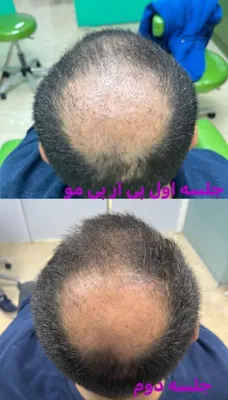 آموزش زیبایی پوست و مو در  اشرفی اصفهانی تهران