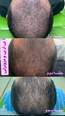 آموزش زیبایی پوست و مو در  اشرفی اصفهانی تهران