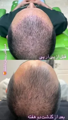 آموزش زیبایی پوست و مو در  اشرفی اصفهانی تهران