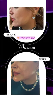 آموزش زیبایی پوست و مو در  اشرفی اصفهانی تهران