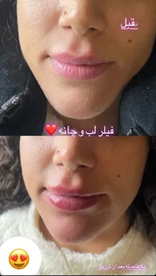آموزش زیبایی پوست و مو در  اشرفی اصفهانی تهران