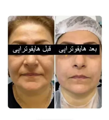 آموزش زیبایی پوست و مو در  اشرفی اصفهانی تهران
