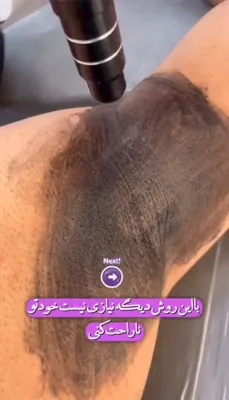 آموزش زیبایی پوست و مو در  اشرفی اصفهانی تهران
