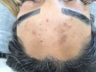 کلینیک زیلاریس در یزد