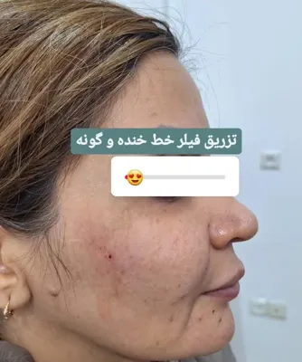 کلینیک زیلاریس در یزد