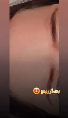 کلینیک زیلاریس در یزد