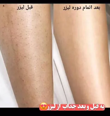 کلینیک زیلاریس در یزد