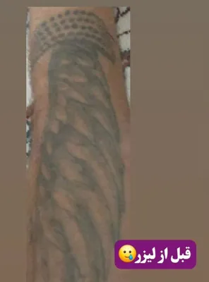 کلینیک زیلاریس در یزد