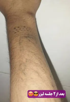 کلینیک زیلاریس در یزد