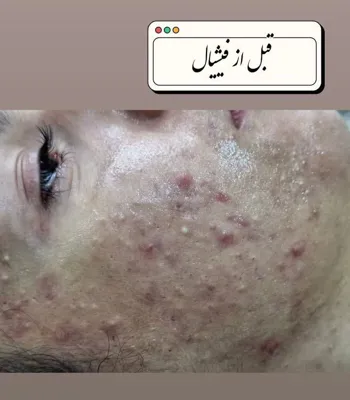 کلینیک زیلاریس در یزد