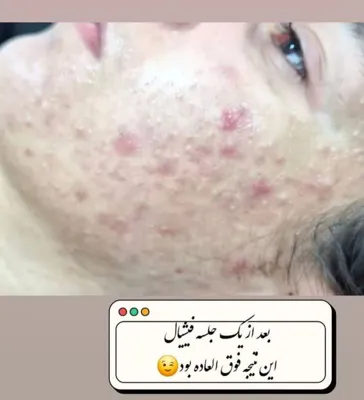 کلینیک زیلاریس در یزد