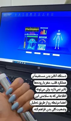 کلینیک زیلاریس در یزد