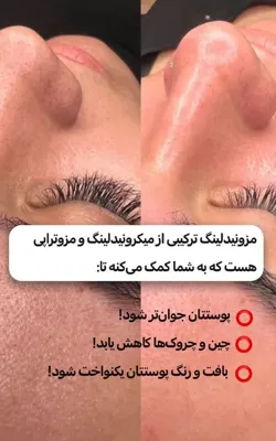 کلینیک زیلاریس در یزد