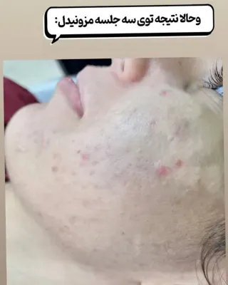 کلینیک زیلاریس در یزد