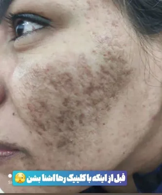 کلینیک زیلاریس در یزد