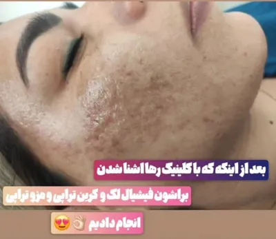 کلینیک زیلاریس در یزد