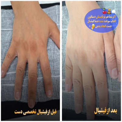 کلینیک زیلاریس در یزد