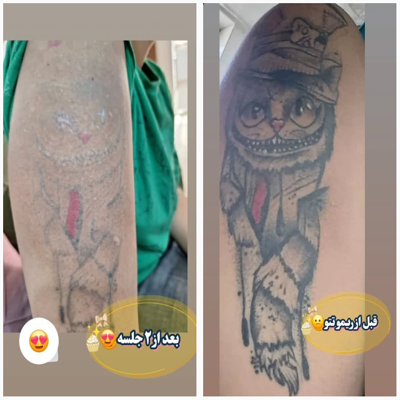 کلینیک زیلاریس در یزد