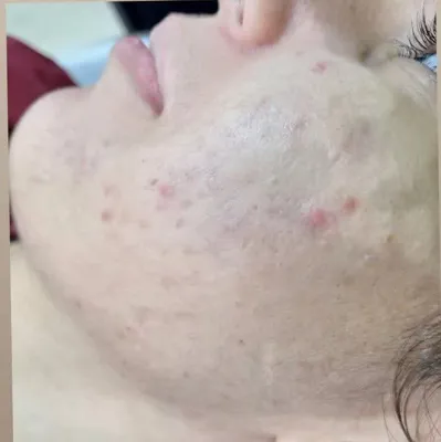 کلینیک زیلاریس در یزد