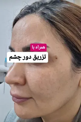 کلینیک زیلاریس در یزد