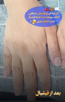 کلینیک زیلاریس در یزد