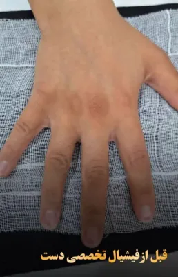 کلینیک زیلاریس در یزد