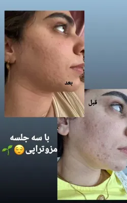 کلینیک زیلاریس در یزد