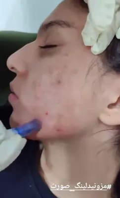 کلینیک زیلاریس در یزد