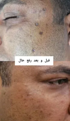 کلینیک زیلاریس در یزد