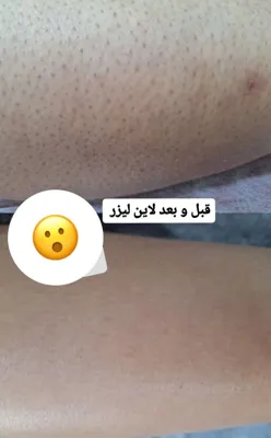 کلینیک زیلاریس در یزد