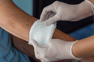 درمان زخم بستر در منزل